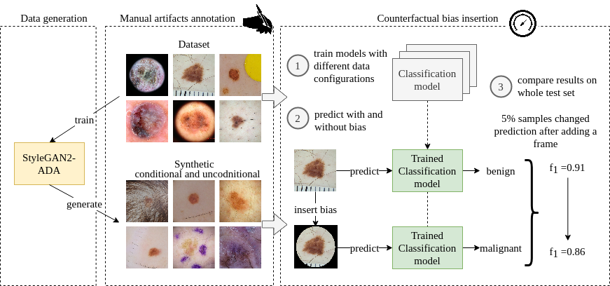 The procedure behind (de)biasing effect of using GAN-based data augmentation