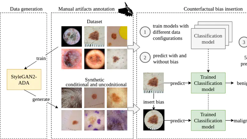 The (de)biasing effect of GAN-based augmentation methods